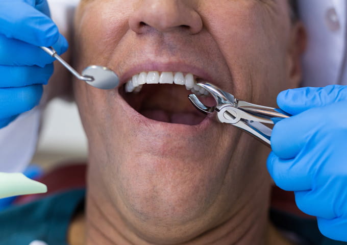 Dentist in McKinney providing same day emergency dental care at Pecan Tree Family Dentistry